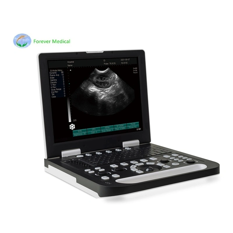 15 Inch Veterinary Ultrasound Imaging System Animals Pregnancy Laptop Ultrasound Scanner