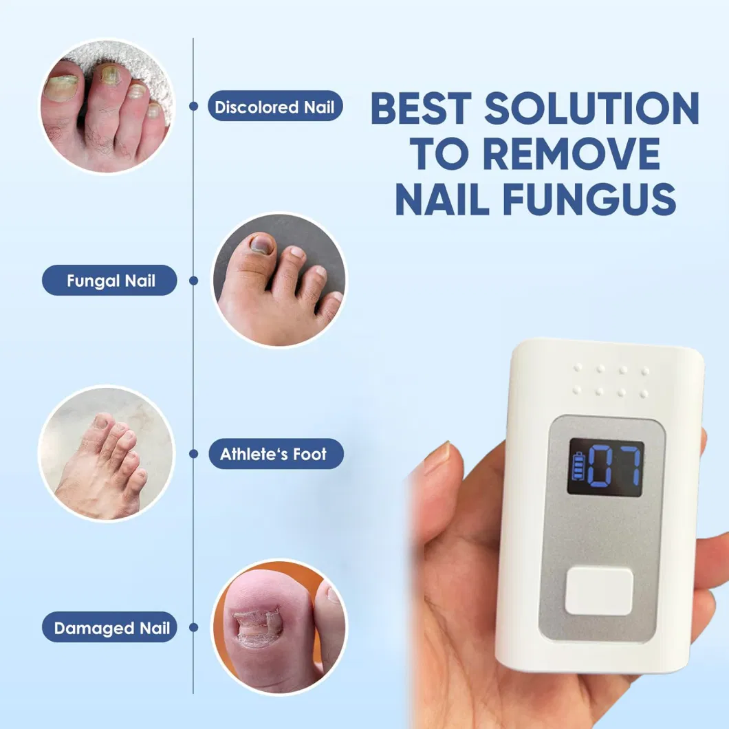 Earsmate Cold Nail Fungus Treatment Laser Therapy Toe Nail Cleaning Physiotherapy Device En01