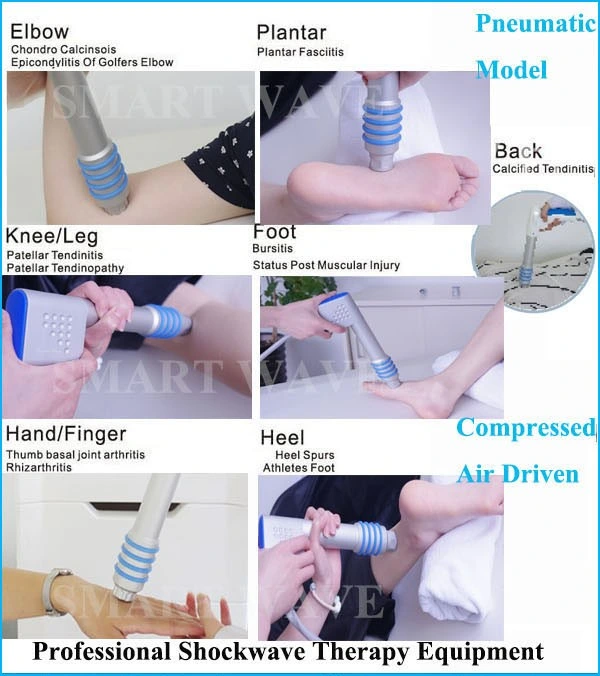 Extracorporal Shock Wave Therapy Device / Eswt for Physical / Achilles Tendon Pain