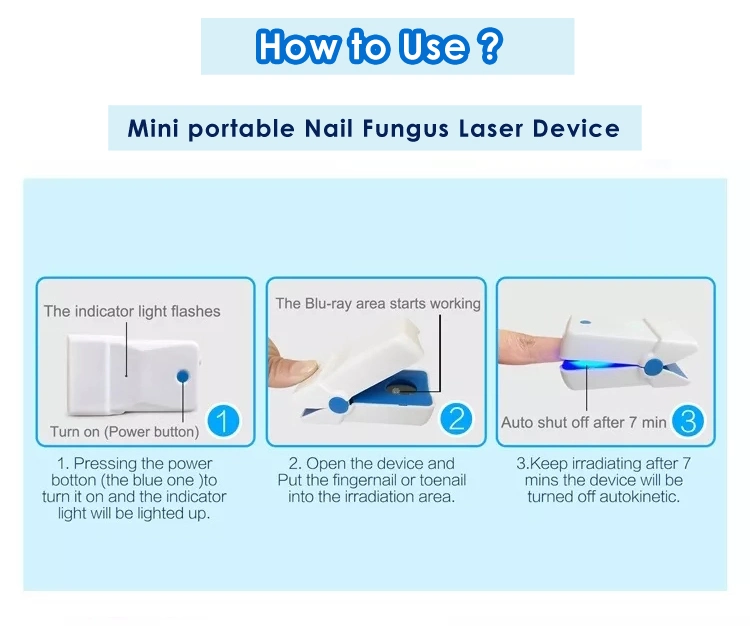 Earsmate Cold Nail Fungus Treatment Laser Therapy Toe Nail Cleaning Physiotherapy Device En01