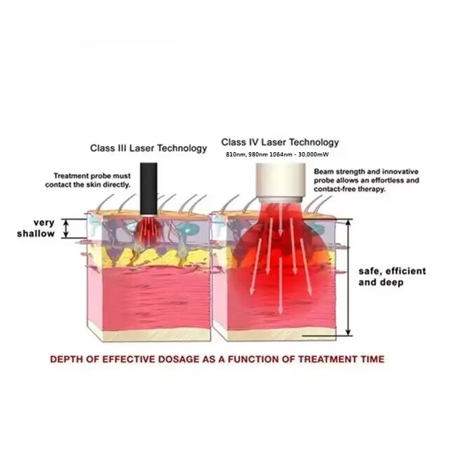 Medical Laser Equipment Class 4 Pain Relief Laser Device for Tissue Repair