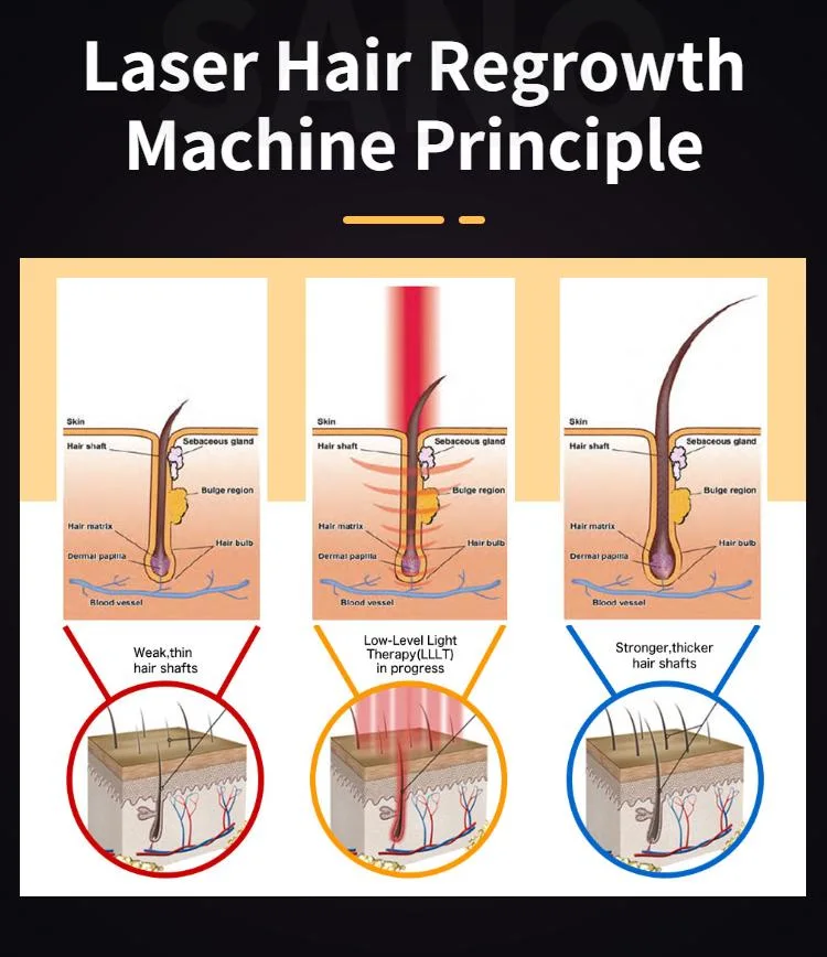 Low Level Laser Therapy Hair Regrow Machine