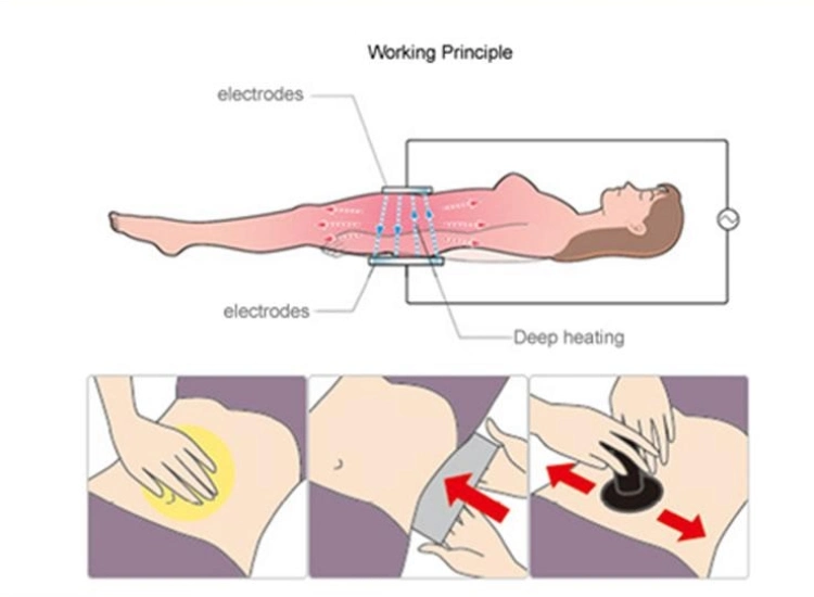 3 Technology Smart Tecar RF Pain Relief EMS Portable Physical Therapy Shock Wave Device for Physiotherapy and ED Treatment