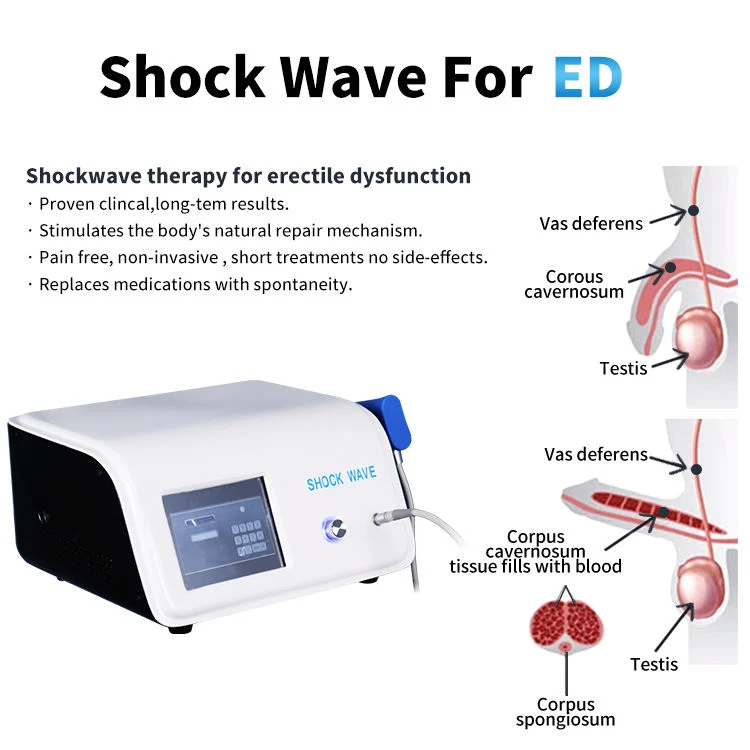 New Ideas Extrcorporeal Shockwave Machine 17 MHz Pneumatic Shockwave Therapy Sotopmed Device for Penis