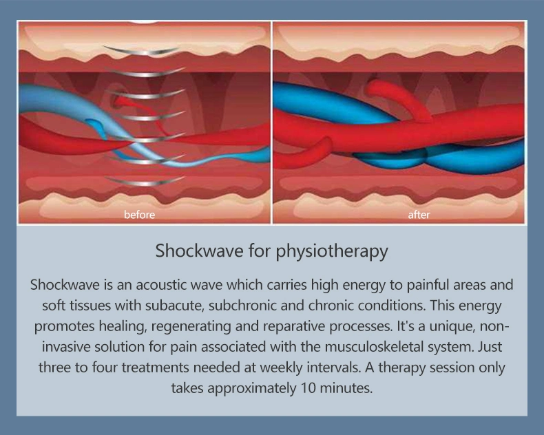 3 Technology Smart Tecar RF Pain Relief EMS Portable Physical Therapy Shock Wave Device for Physiotherapy and ED Treatment