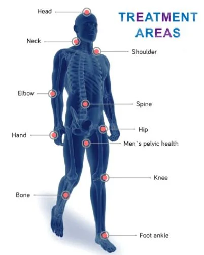 Shockwave Erectile Dysfunction Retatment Equipment for ED Shock Wave Therapy Device