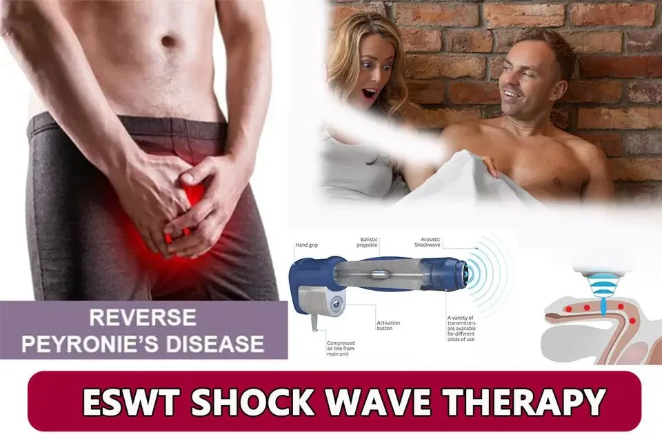 Physiotherapy Shock Waves Professional Shockwave Therapy Machine Back Massager for Waist Pain Relief Body Relax