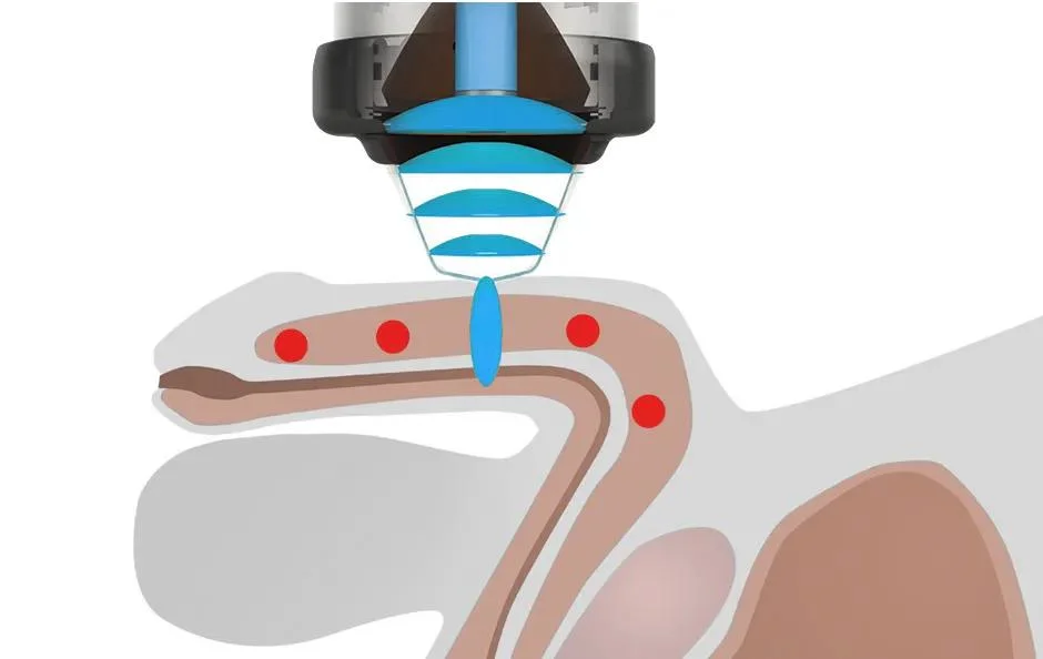 Eswt Shock Wave Therapy Machine Shockwave Physiotherapy for Reduce Joints Pain