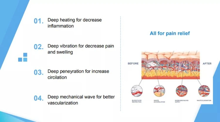 Deep Penetration Effective Pain Relief Clinic Use Physiotherapy Ultrasound