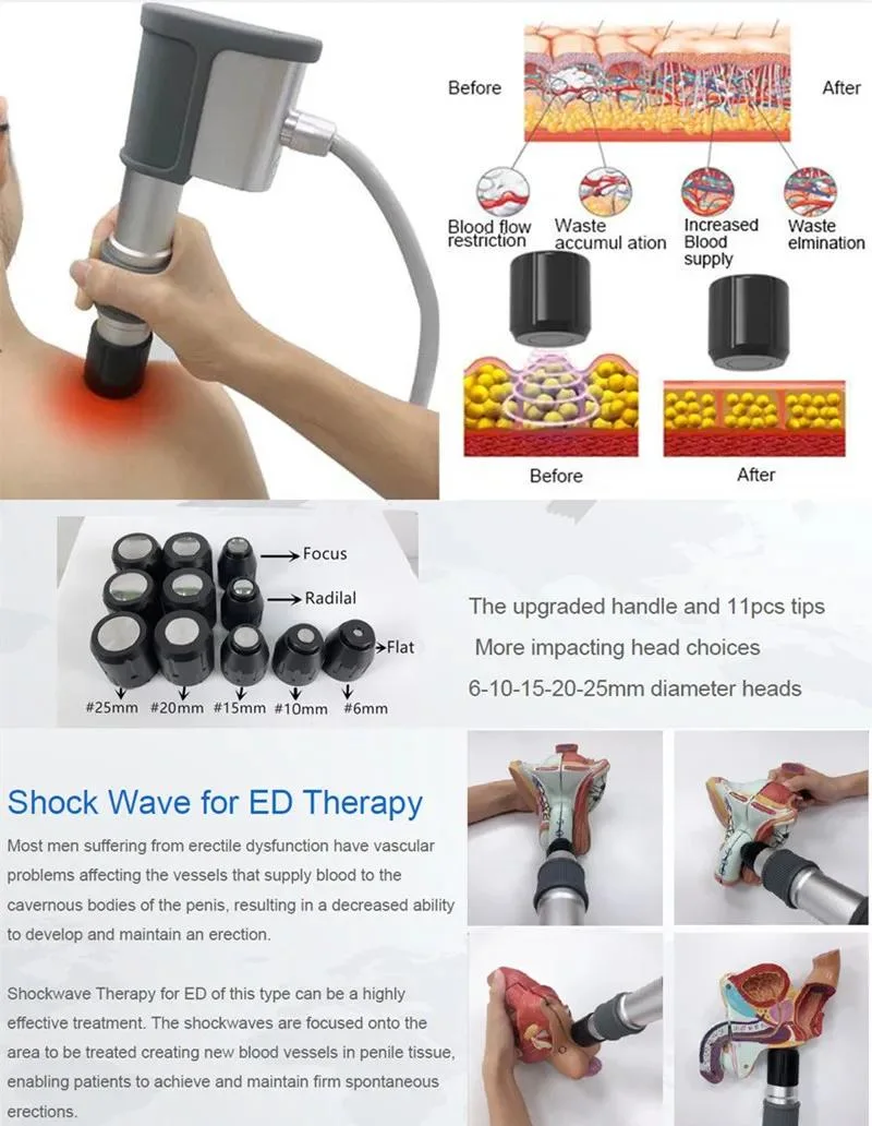 2023 New 6 in 1 Smart Tecar RF Shockwave Machine for Pain Relief ED Treatment Physical Therapy Equipment