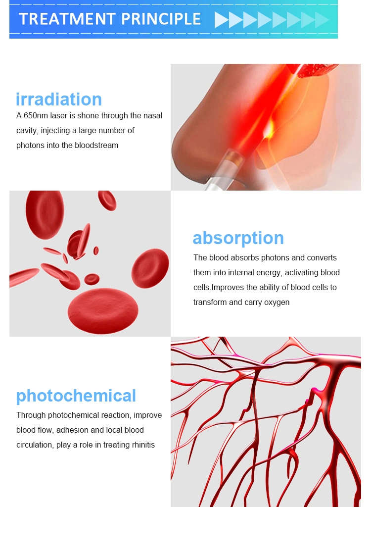 Low Level Laser Therapy Machine Allergic Rhinitis Treatment Instrument Infrared Laser Acupuncture Therapy Medical Device