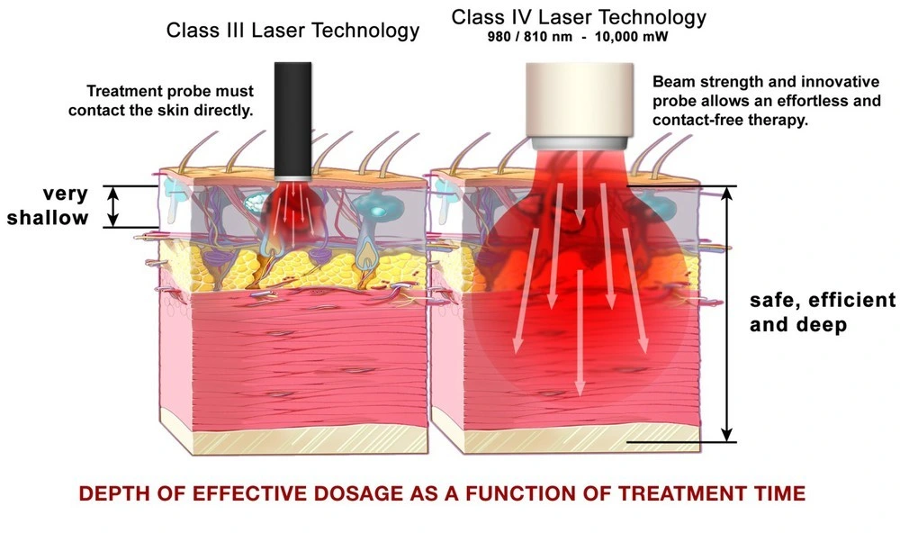 High Power 650nm 808nm Class 4 Laser Pain Relief Device