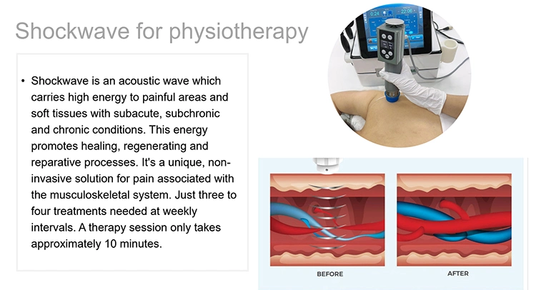 ED Treatemtn Pain Relief 3 in 1 Cet Ret Onde De Choc SA-Sw14 Magnetoterapia Shock Wave Therapy