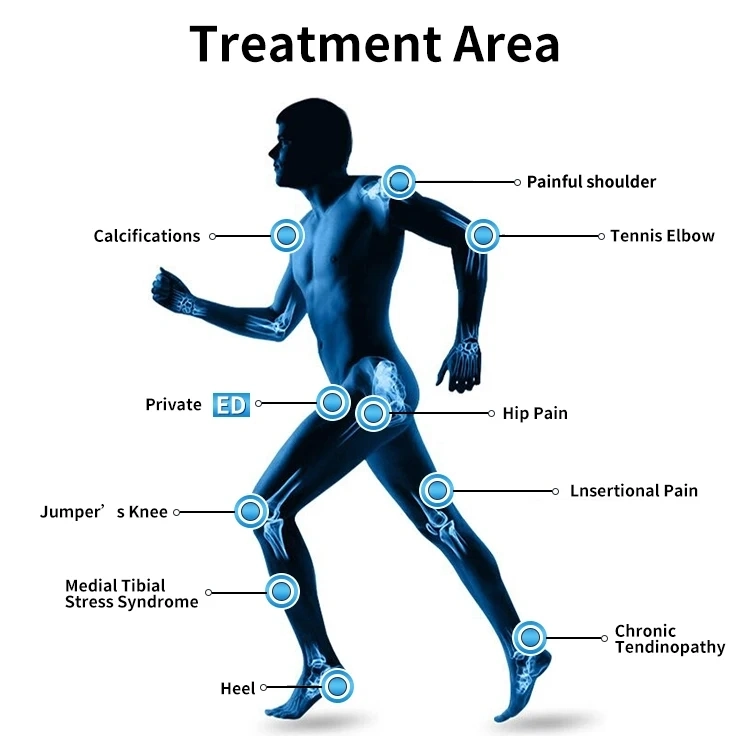 Eswt Pneumatic High Intensity Focused Shockwave Therapy Machine for Rehabilitation &amp; ED Treatment