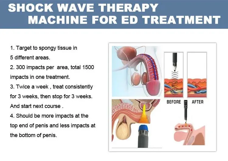 Physiotherapy Instrument Pain Treatment Physical Shock Wave / Shockwave Therapy Machine for ED