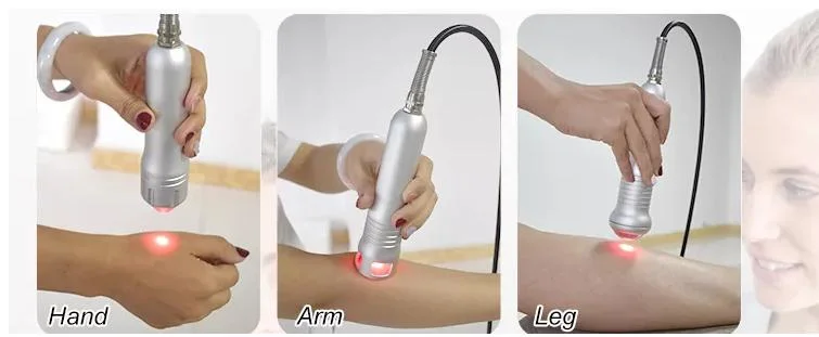 2022 Distributor Physiotherapy Products Therapy Equipment Laser 980nm Pain Relief