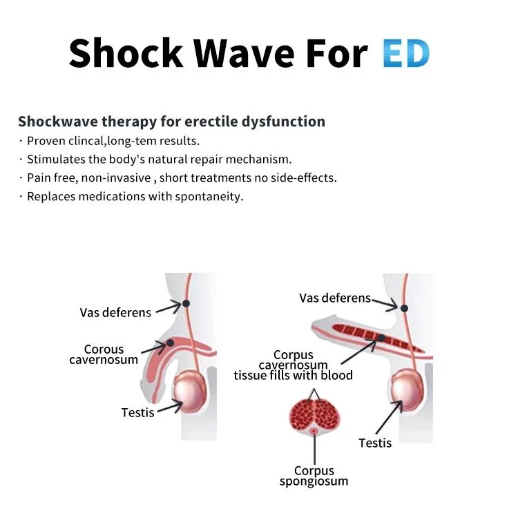 Physiotherapy Instrument Pain Treatment Physical Shock Wave / Shockwave Therapy Machine for ED