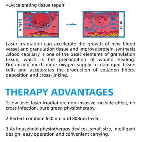 Home Care Medical Pain Relief Therapy Physiotherapy Low Level Laser Therapy