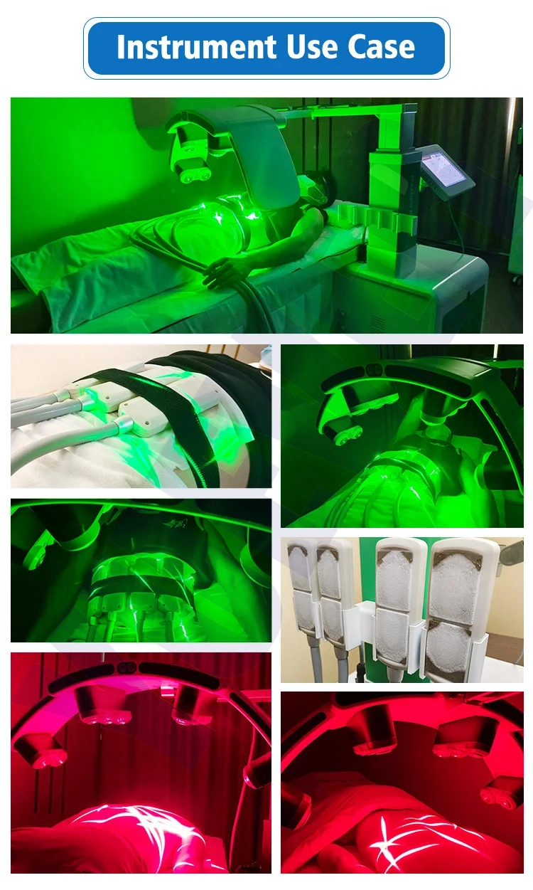 532nm Cold Laser Therapy Erchonia Emerald Laser Zerona Z6 10d Maxlipo Cryo Pads Cryoplates Master Fat Loss Laser 10d