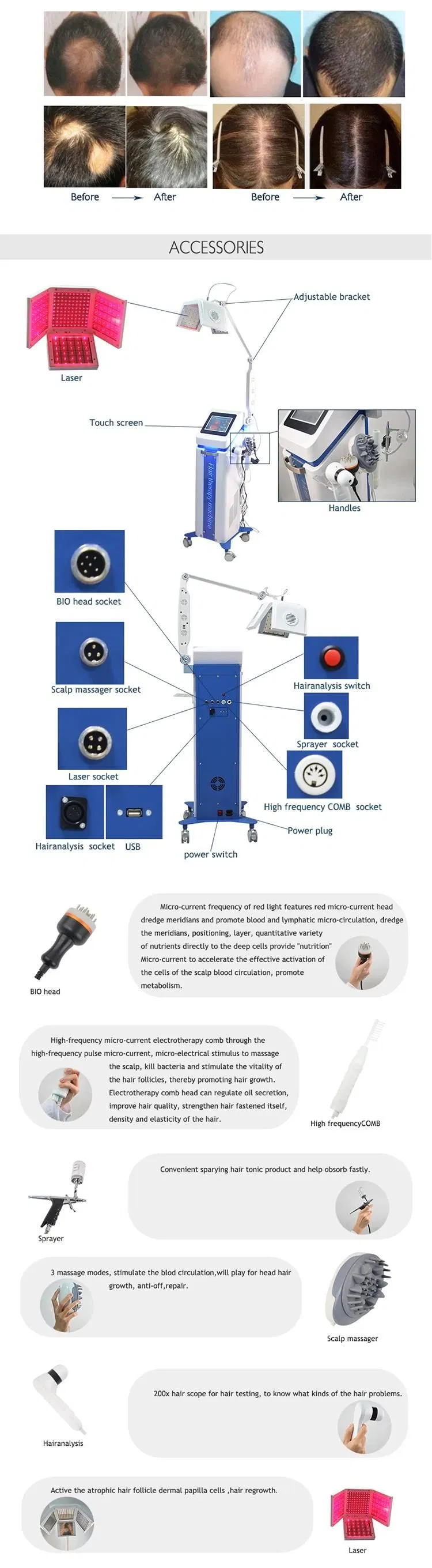 Diode Laser 650nm Red Hair Regrowth Machine Low Level Laser Light Therapy Anti Hair Loss Growth Device 272 277