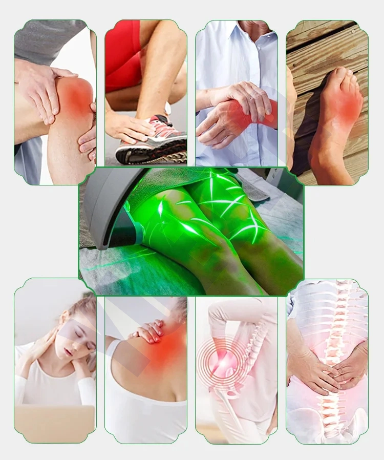 10d Lipo Laser Fat Removal 10d Cellulite Reduction 532nm Green Light Therapy Cold Laser Fast Slim Machine for Beauty