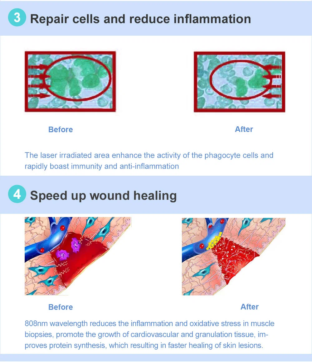 Portable Diminish Inflammation Cold Laser Therapy Pain Relief