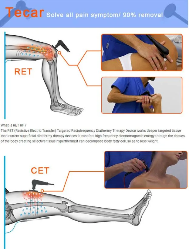 Physical Therapy Equipments ED Shock Wave Therapie Ret Cet Smart Tecar Wave 448kHz Tecar Therapy Physiotherapy Ultrasound Machine