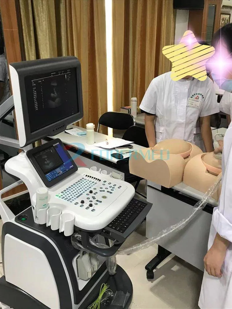 High-End Trolley Ultrasound 4D Dopper Ultrasound Scanner Machine for Abdomen Obstetrics