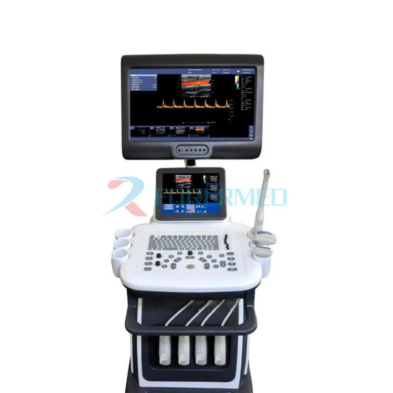 High-End Trolley Ultrasound 4D Dopper Ultrasound Scanner Machine for Abdomen Obstetrics