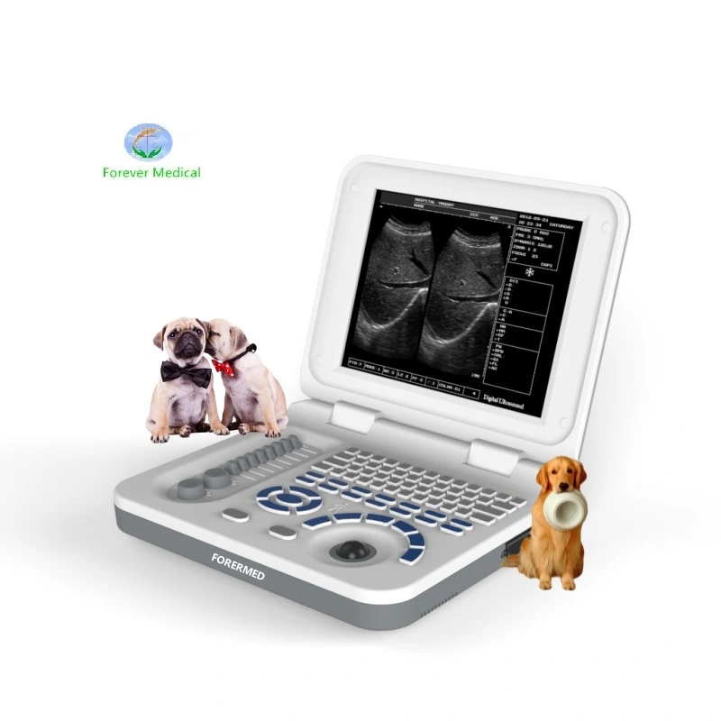 High-End Trolley Ultrasound 4D Dopper Ultrasound Scanner Machine for Abdomen Obstetrics