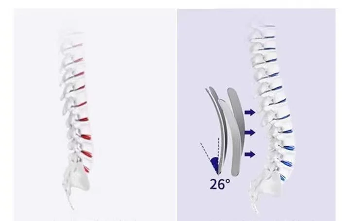 Electric Inflatable Waist Support Lumbar Traction Brace Inflatable Back Spinal Decompression Belt