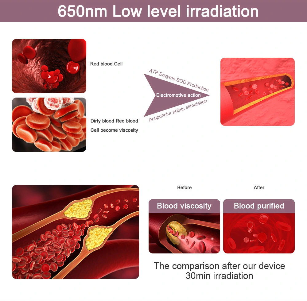 Red Light Therapy Wrist Watch, Low Intensity Acupuncture Infrared Light for Knee Shoulder Body Rhinitis Pain Relief