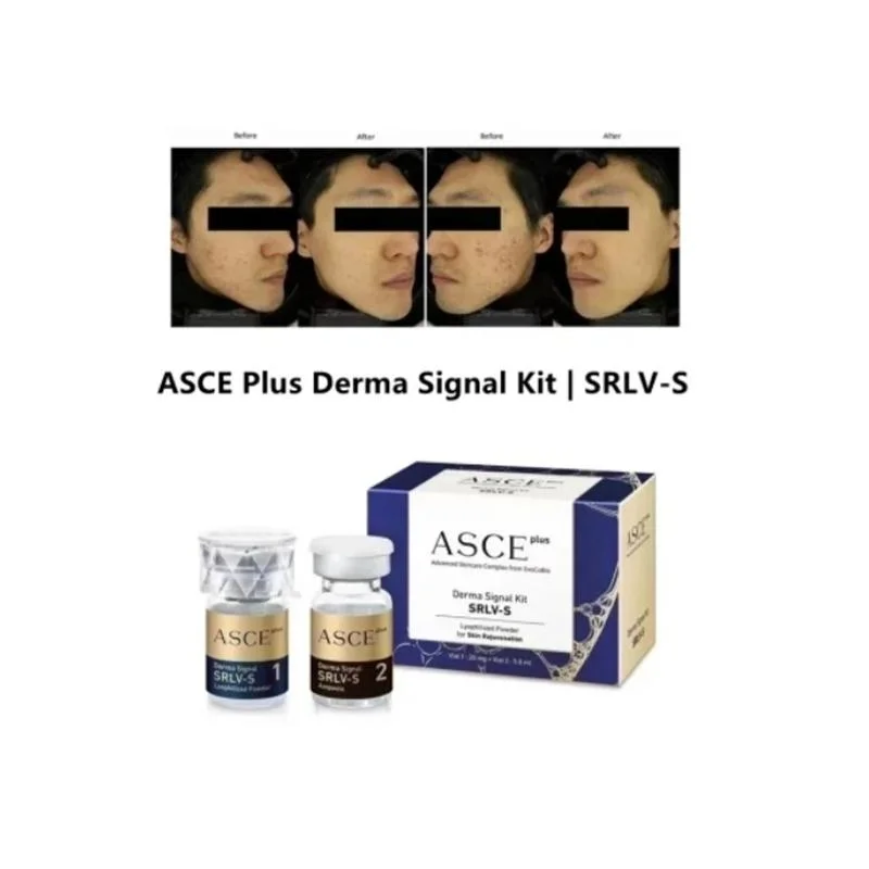 Asce Powerful Anti-Aging Set Whitening Moisturizing Blemishes Hyaluronic Acid Injection Vitamin C