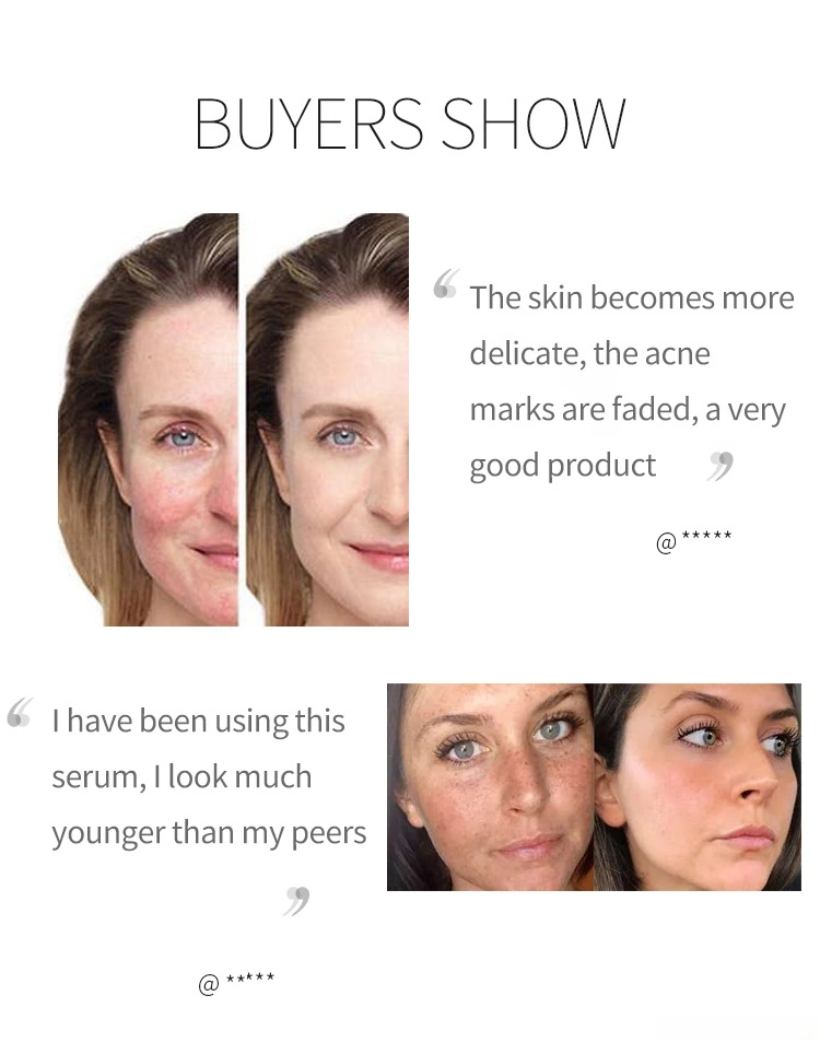 Beauty Cosmetics Skin Care Shrink Pores Anti Aging Vitamin B3 Niacinamide Serum