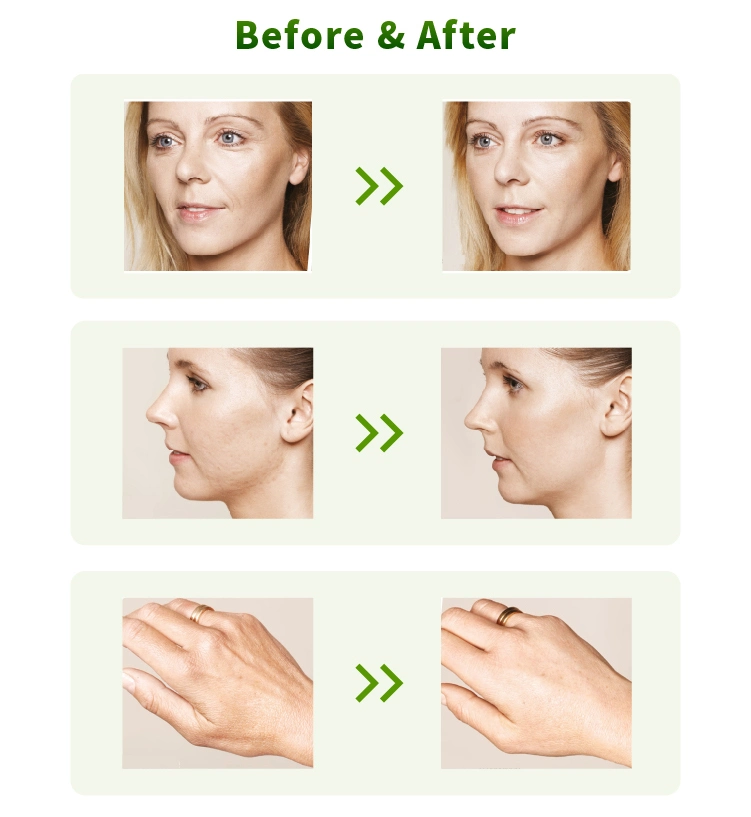 Mesocel Korea CE Private Label Anti Aging Deep Hydration Body Whitening Skin Booster Meso Mesotherapy Serum for Microneedling