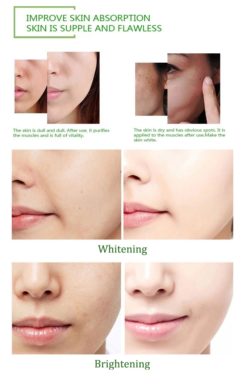 Aichun Aloe Vera Moisturizing Oil Control Lightening Acne Seal Melanin Repair Skin Facial Essence Serum