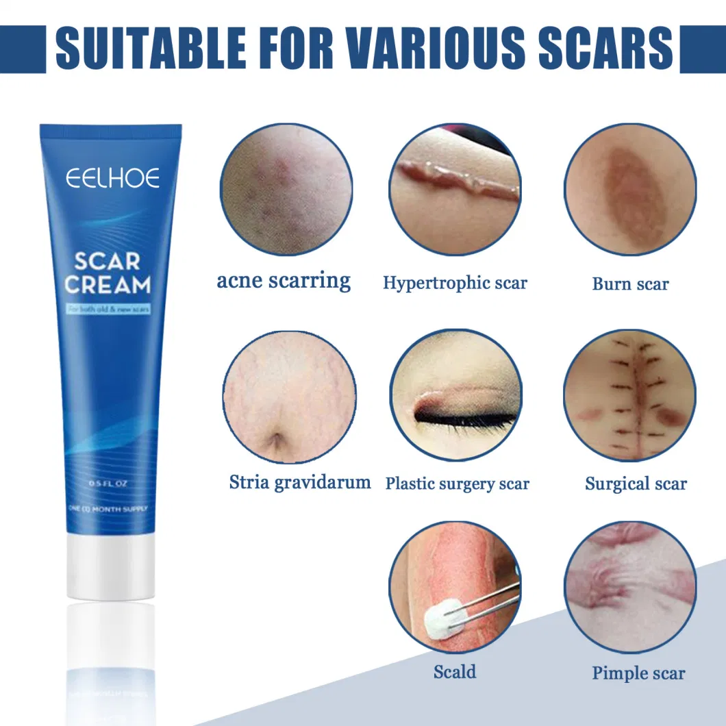 Face Pimples Acne Scar Removal Cream