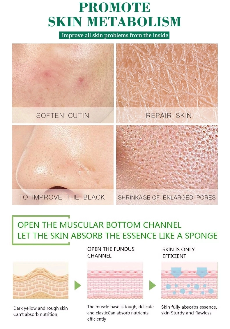 Aichun Aloe Vera Moisturizing Oil Control Lightening Acne Seal Melanin Repair Skin Facial Essence Serum