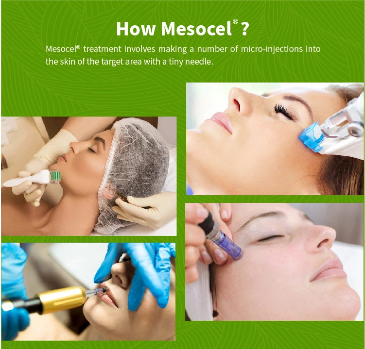 Mesocel Korea CE Private Label Anti Aging Deep Hydration Body Whitening Skin Booster Meso Mesotherapy Serum for Microneedling