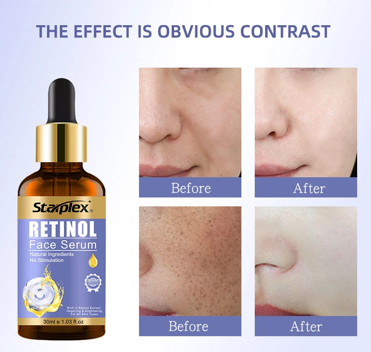 OEM/ODM Private Label Anti Wrinkle Facial Serum Organic Anti-Aging Whitening Face Care Retinol Serum