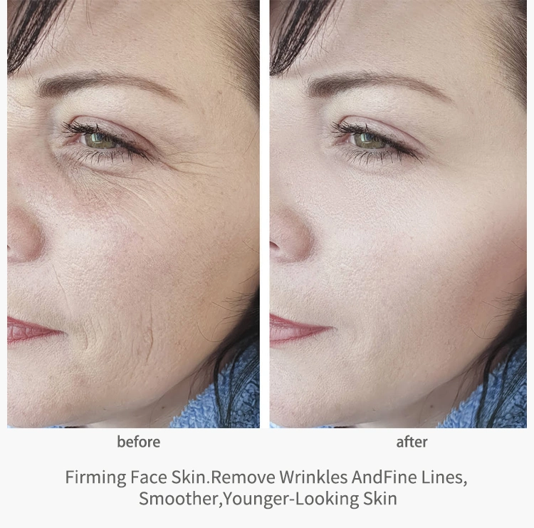 Private Label Natural Vitamin a Brightening Reduce Wrinkles Face Cream Whitening Dark Spot Removing Cream