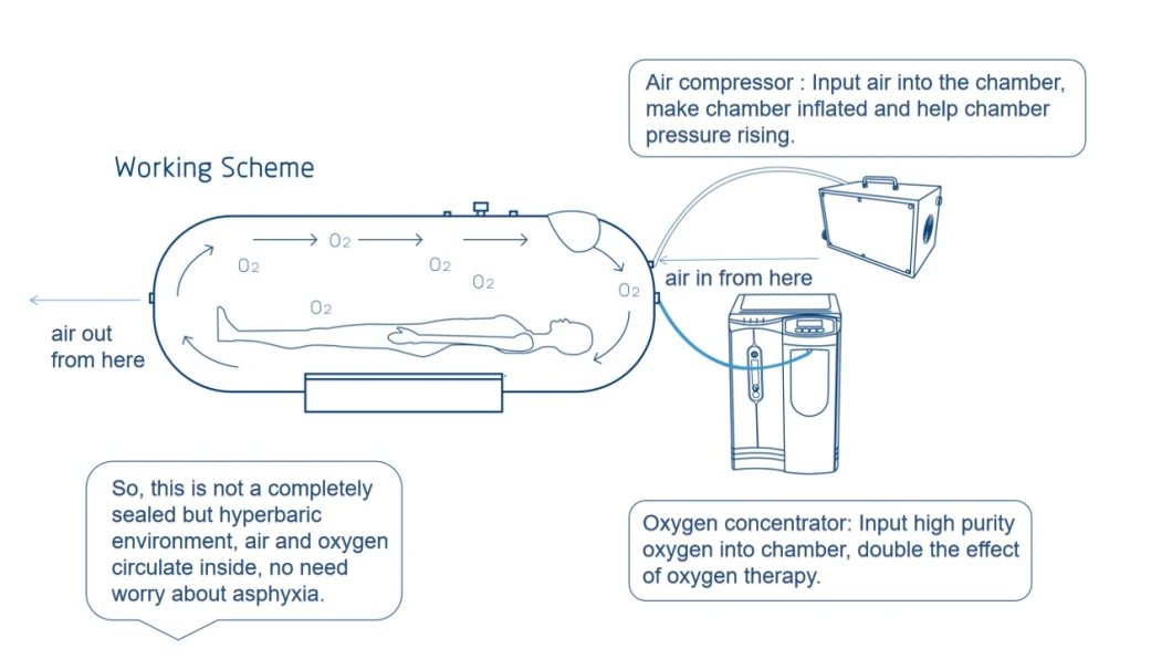 ST801 Hyperbaric Oxygen Chamber for Wound Healing