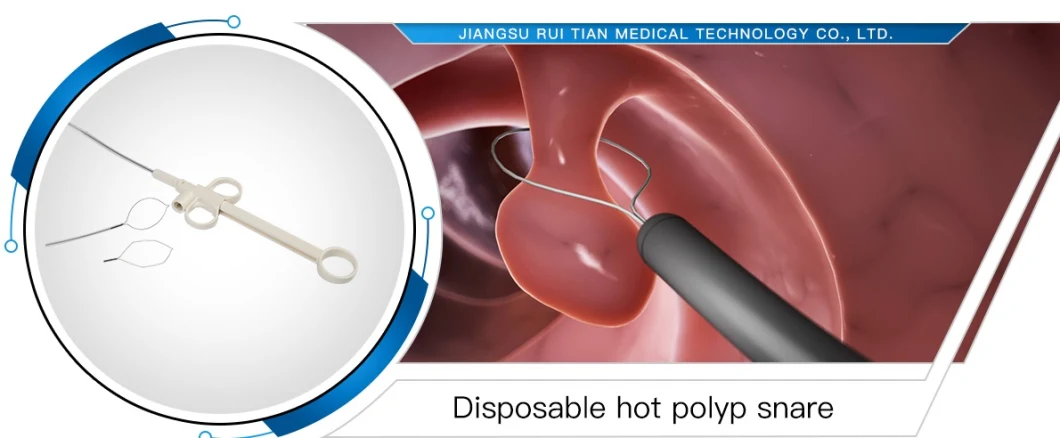 Electric Medical Devices for Polypectomy of Digestive and Respiratory Tracts