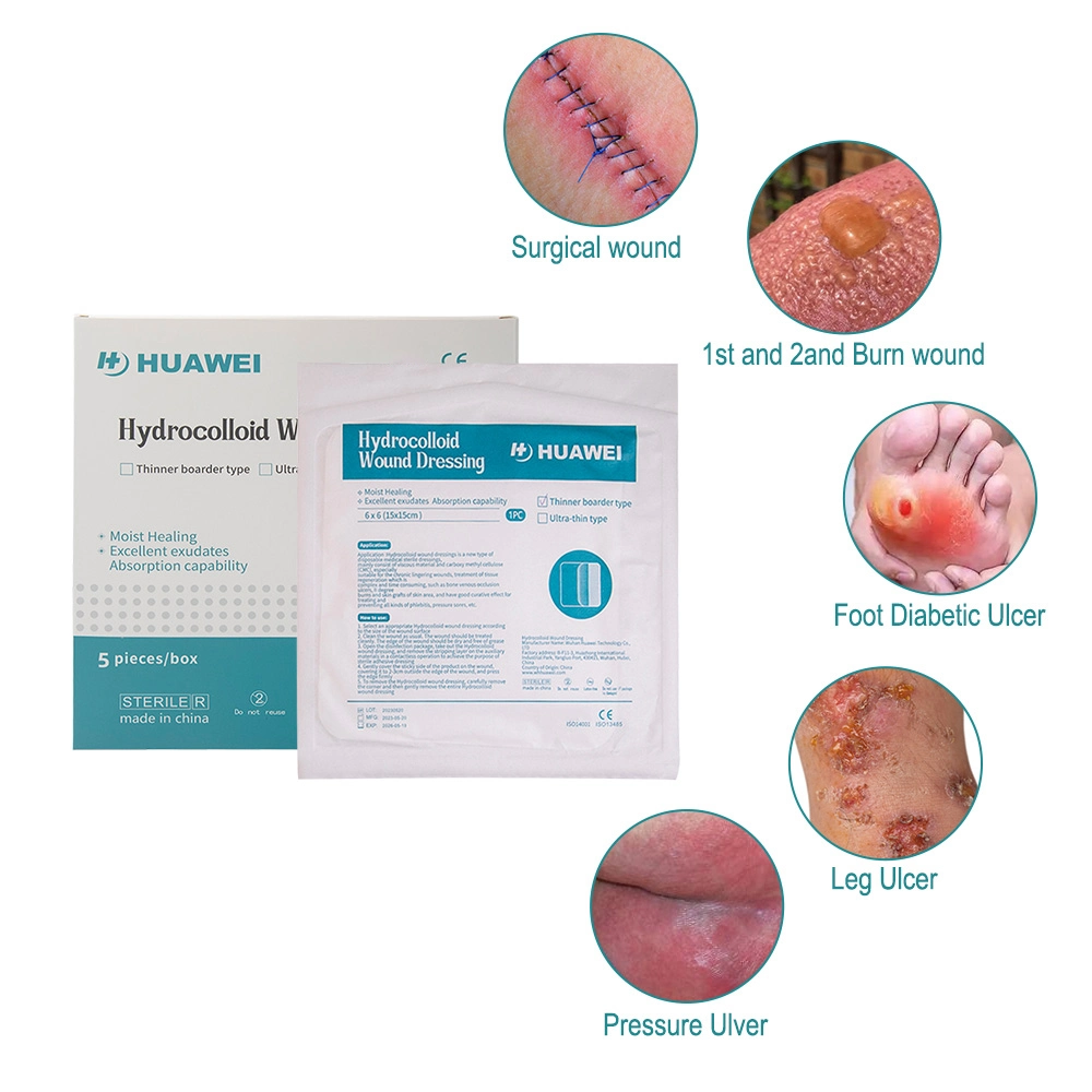 Huawei Wound Care Products Sterile Hydrocolloid Burn Dressing Large Size Adhesive Waterproof Hydrocolloid Wound Dressing