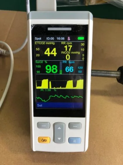 SpO2 Pet Multi Parameters Handheld Monitor Veterinary Oximeters with Touch Screen