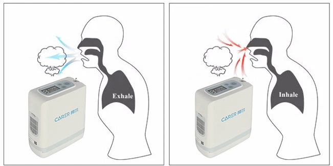 Carer Outdoor Use Large Flow 96% Mini Oxygen-Concentrator Generator with Battery Small Portable Pulse Oxygen Concentrator