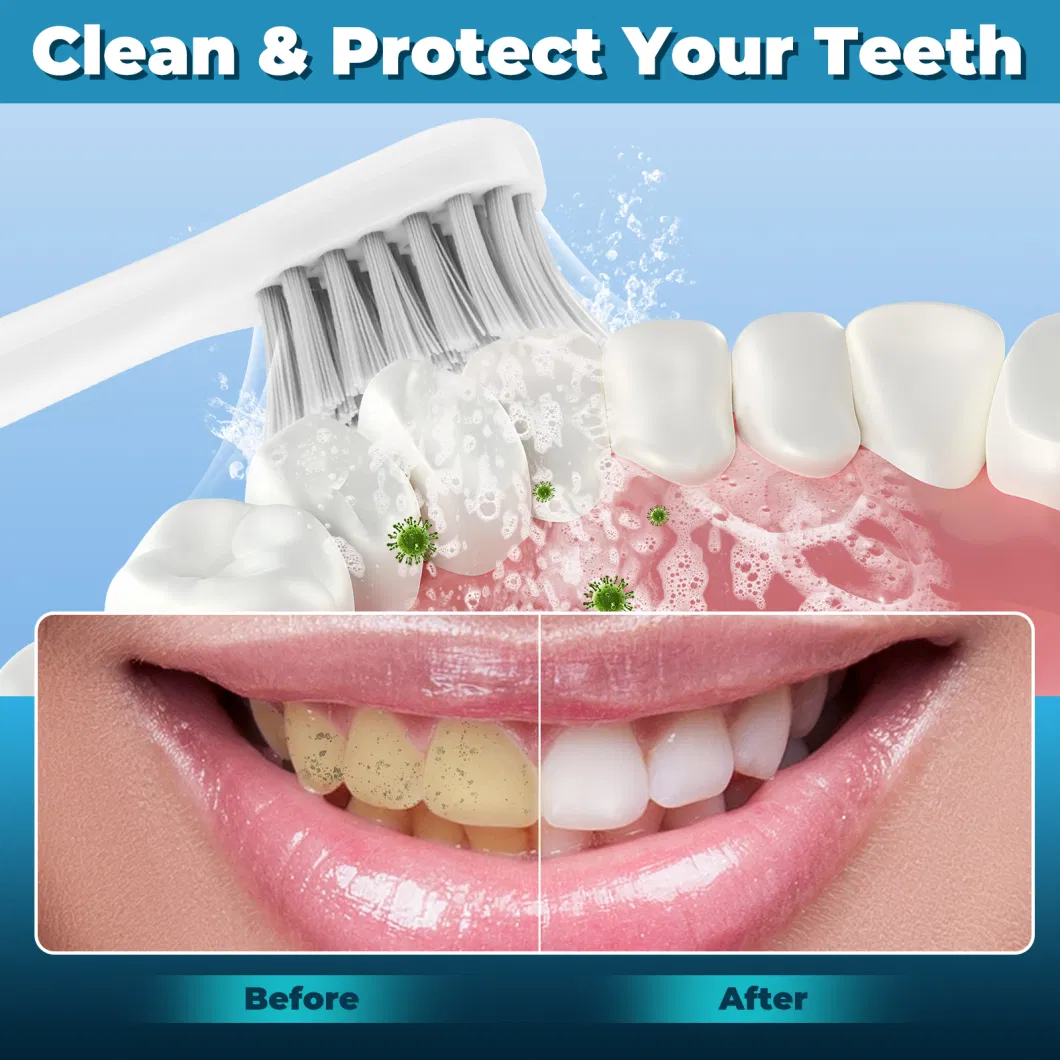 Jssan 3 in 1 Teeth Whitening Kit Dental Oral Irrigator Teeth Cleaner Ultrasonic Electric Toothbrush Water Flosser for Home Travel