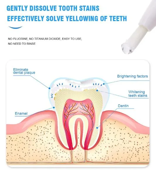 Private Label Teeth Whitening Pen Aluminum/Plastic Whitening Pen with Custom Logo/Package (CE Approved) Clean Teeth Toothbrush