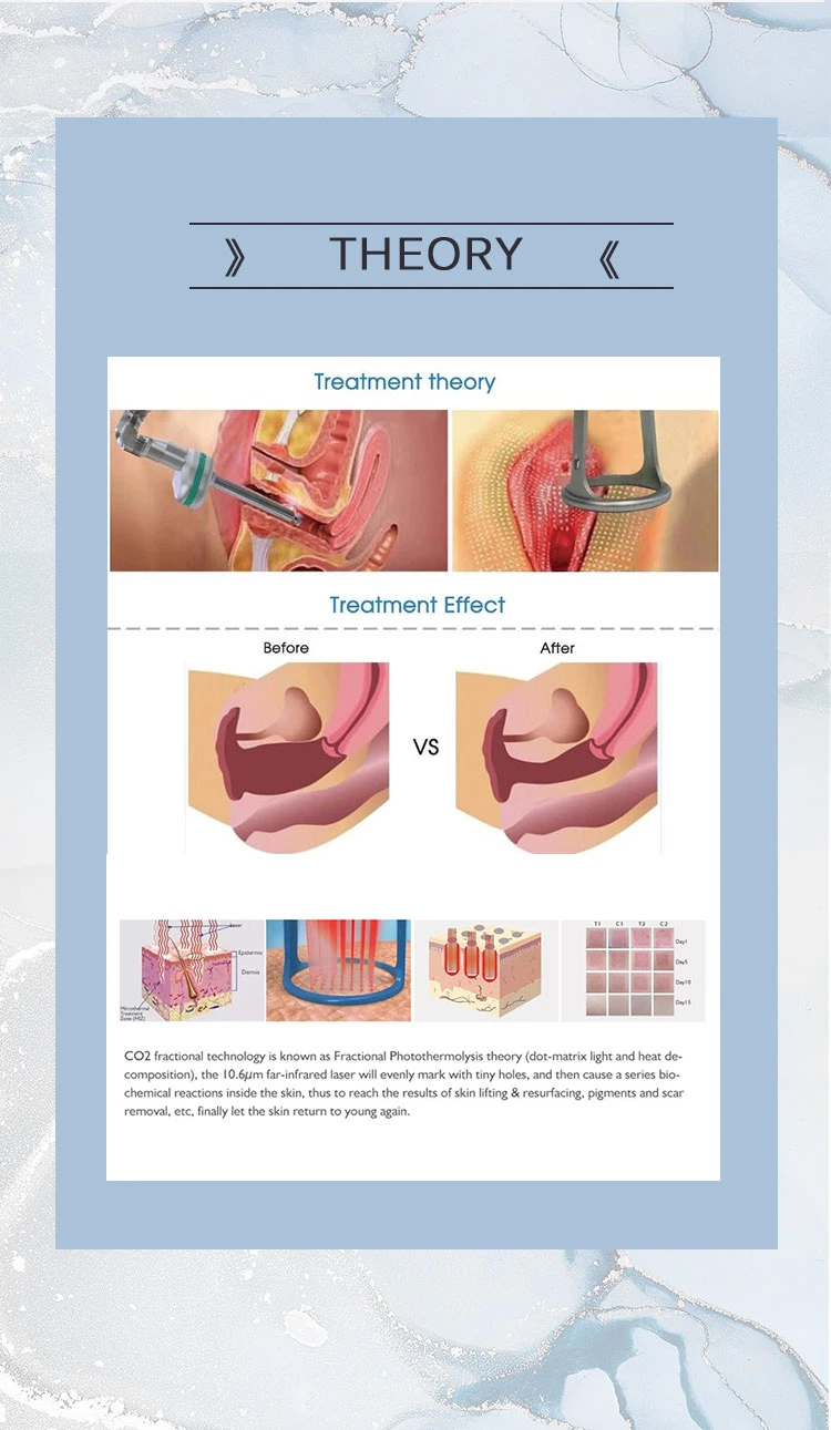 Fractional CO2 Laser Machine for Skin Resurfacing Scar Removal Vaginal Tightening