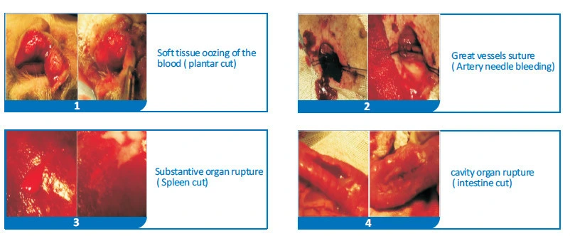 Manufacture ISO Approved Surgiclean 0.5g, 1g, 3G, 5g Medical Supplies Hemostasis